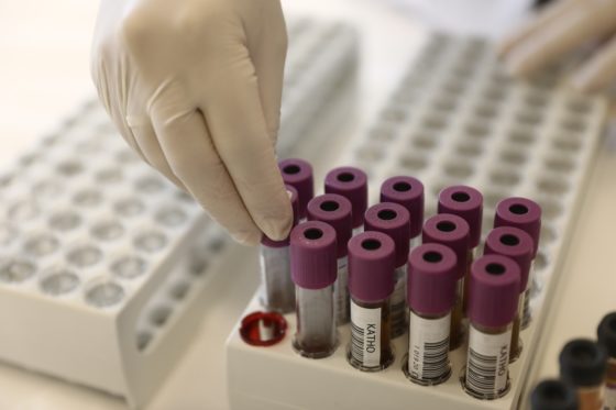 Νοσοκομεία σε αιμοδοτική καραντίνα λόγω κρουσμάτων του ιού του Δυτικού Νείλου