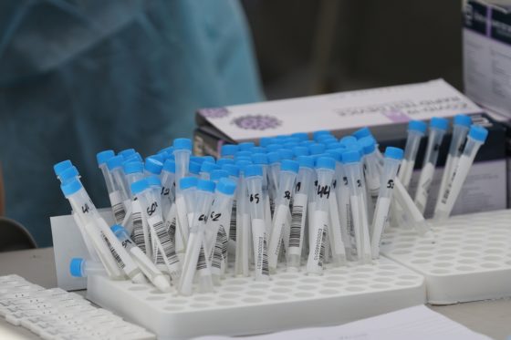 Κατάργηση των δωρεάν rapid test και για τους καρκινοπαθείς στο ΠΑΓΝΗ