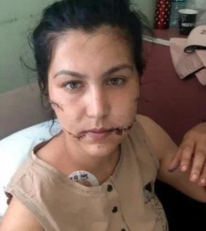 Άγρια έμφυλη βία στην Τουρκία – Μαχαίρωσε τη γυναίκα του 104 φορές