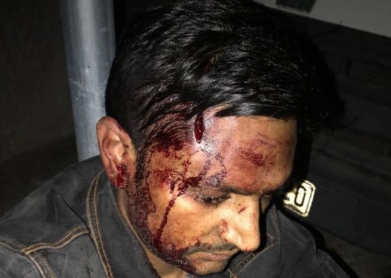 Άγρια δολοφονική επίθεση φασιστών εναντίον τριών μεταναστών καταγγέλλει η ΚΕΕΡΦΑ